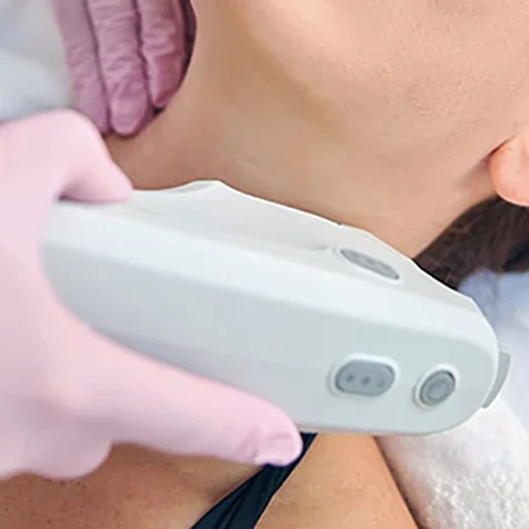 Ultherapy ultrasound skin treatment in San Ramon